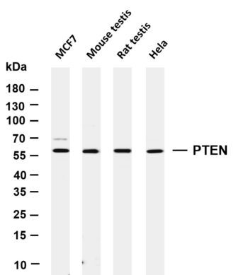 PTEN Rabbit Monoclonal Antibody