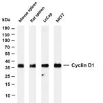 Cyclin D1 Rabbit Monoclonal Antibody