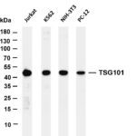TSG101 Rabbit Monoclonal Antibody
