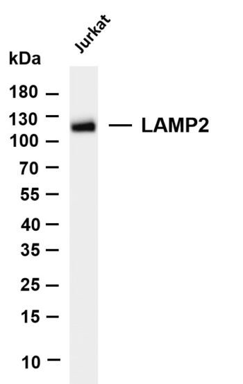 LAMP2 Rabbit Monoclonal Antibody