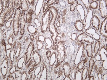 LAMP2 Rabbit Monoclonal Antibody - Image 2