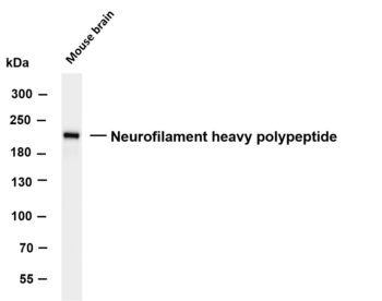 Neurofilament heavy polypeptide Rabbit Monoclonal Antibody