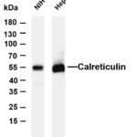 Calreticulin Rabbit Monoclonal Antibody