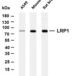 LRP1 Rabbit Monoclonal Antibody
