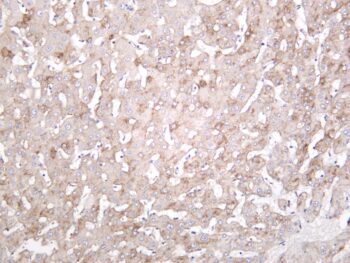 LRP1 Rabbit Monoclonal Antibody - Image 2