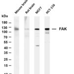 FAK Rabbit Monoclonal Antibody