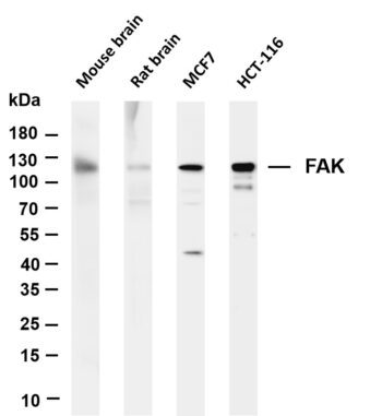 FAK Rabbit Monoclonal Antibody