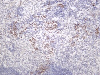 FAK Rabbit Monoclonal Antibody - Image 2