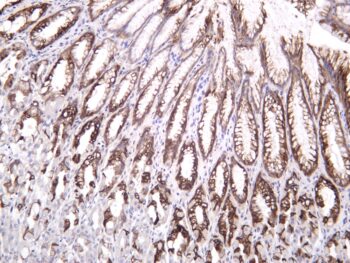 Mucin 5AC Rabbit Monoclonal Antibody - Image 2
