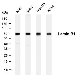 Lamin B1 Rabbit Monoclonal Antibody