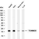 TOMM20 Rabbit Monoclonal Antibody