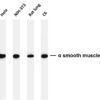 α smooth muscle actin Rabbit Monoclonal Antibody