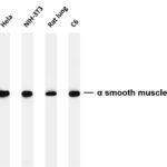 α smooth muscle actin Rabbit Monoclonal Antibody