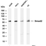Smad2 Rabbit Monoclonal Antibody