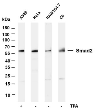 Smad2 Rabbit Monoclonal Antibody