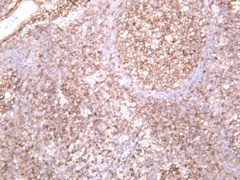 Fas Rabbit Monoclonal Antibody - Image 2