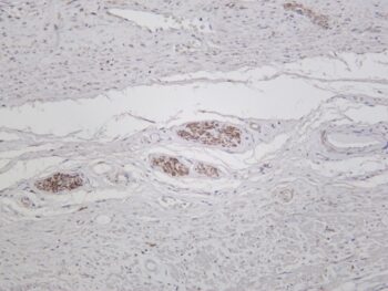 LC3A Rabbit Monoclonal Antibody - Image 2