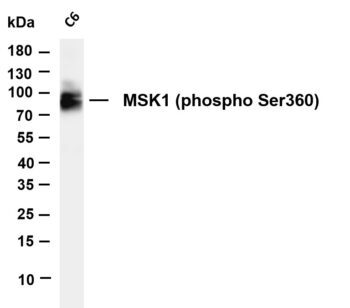 MSK1 (Phospho-Ser360) Rabbit Monoclonal Antibody