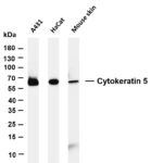 Cytokeratin 5 Rabbit Monoclonal Antibody