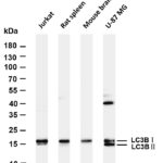LC3B Rabbit Monoclonal Antibody