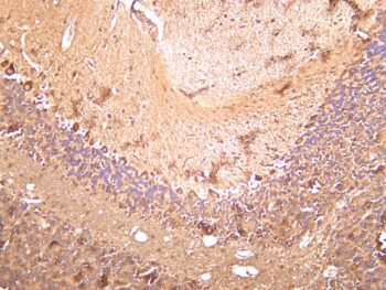LC3B Rabbit Monoclonal Antibody - Image 2