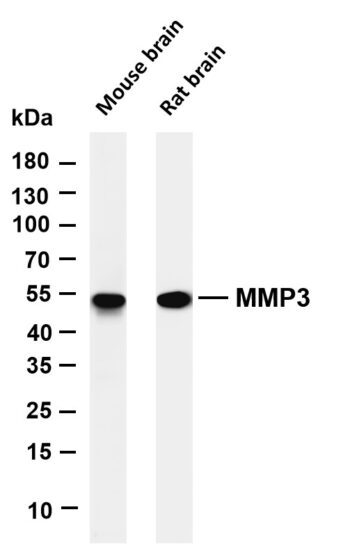 MMP3 Rabbit Monoclonal Antibody