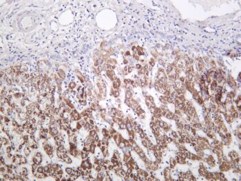 MMP3 Rabbit Monoclonal Antibody - Image 2
