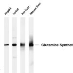 Glutamine Synthetase Rabbit Monoclonal Antibody