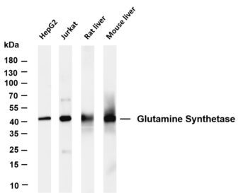 Glutamine Synthetase Rabbit Monoclonal Antibody