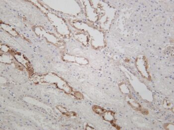 NQO1 Rabbit Monoclonal Antibody - Image 2