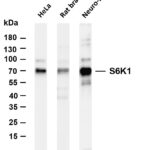 S6K1 Rabbit Monoclonal Antibody