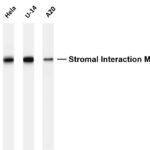 Stromal Interaction Molecule 1 Rabbit Monoclonal Antibody