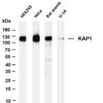 KAP1 Rabbit Monoclonal Antibody