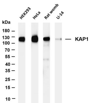 KAP1 Rabbit Monoclonal Antibody