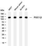 PGC1 β Rabbit Monoclonal Antibody