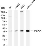 PCNA Rabbit Monoclonal Antibody