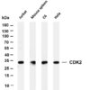 CDK2 Rabbit Monoclonal Antibody