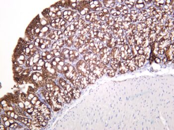 EpCAM Rabbit Monoclonal Antibody - Image 2
