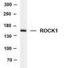 ROCK1 Rabbit Monoclonal Antibody