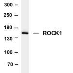 ROCK1 Rabbit Monoclonal Antibody
