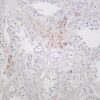 ROCK1 Rabbit Monoclonal Antibody - Image 2
