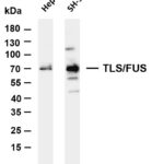 TLS/FUS Rabbit Monoclonal Antibody
