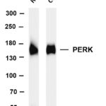 PERK Rabbit Monoclonal Antibody