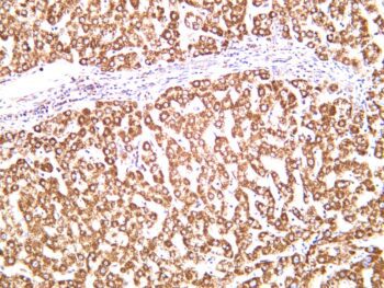 Hsp60 Rabbit Monoclonal Antibody - Image 2