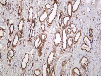 LAMP1 Rabbit Monoclonal Antibody - Image 2