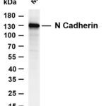 N Cadherin Rabbit Monoclonal Antibody