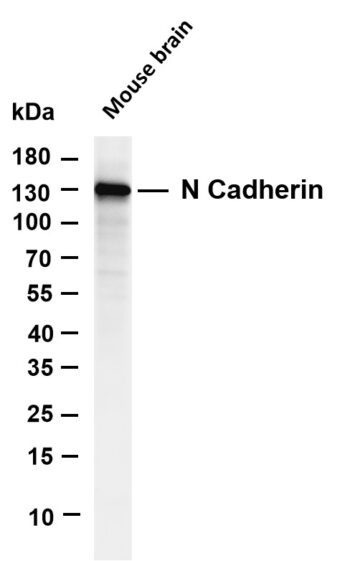 N Cadherin Rabbit Monoclonal Antibody