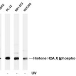 Histone H2A.X (Phospho-Ser139) Rabbit Monoclonal Antibody