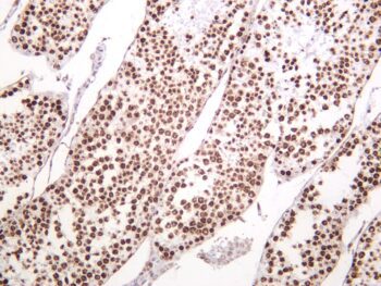 Histone H2A.X (Phospho-Ser139) Rabbit Monoclonal Antibody - Image 2