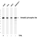 Smad2 (Phospho-Ser250) Rabbit Monoclonal Antibody